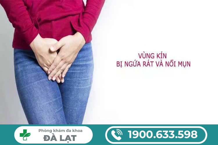 Hình ảnh minh họa